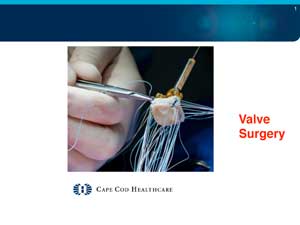 Valve Surgery