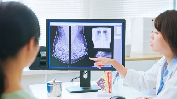 Double mastectomy doesn’t improve breast cancer survival rate