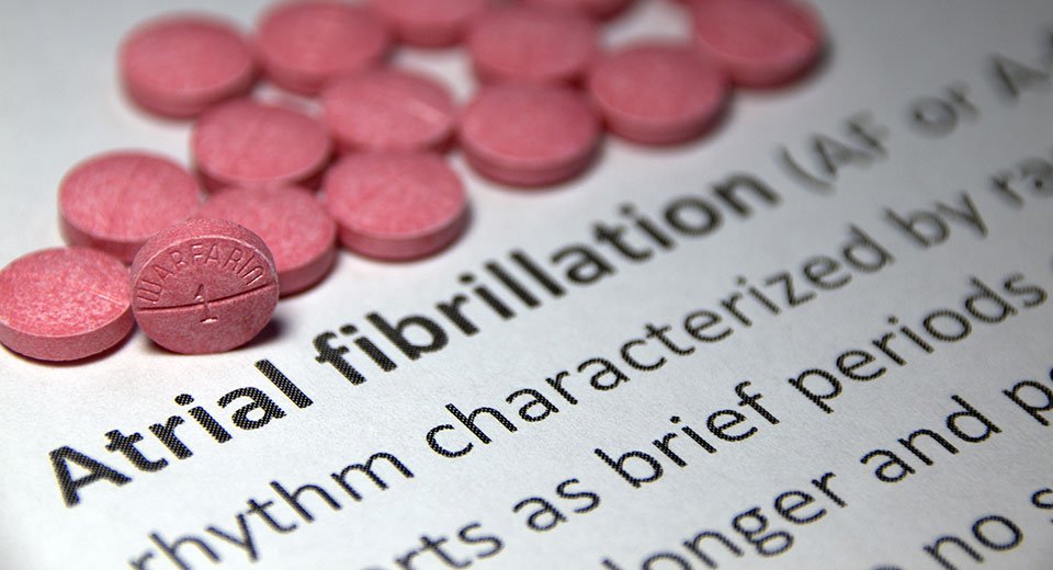 Do you have AFib, and is it being treated?