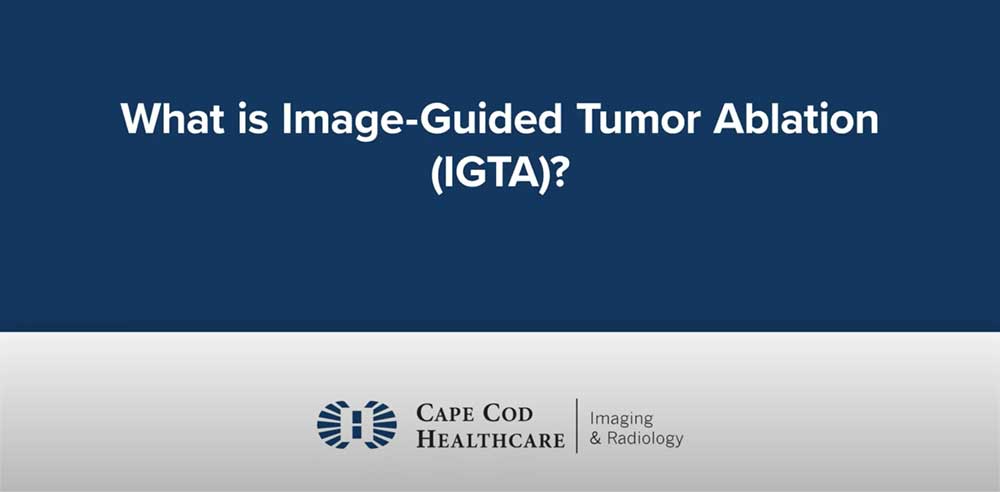 What is IGTA?